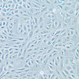 10倍相衬物镜下贴壁生长的VERO细胞状态