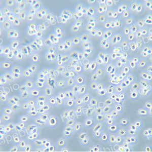 10倍相衬物镜下正在被0.25%胰蛋白酶消化处理的VERO细胞