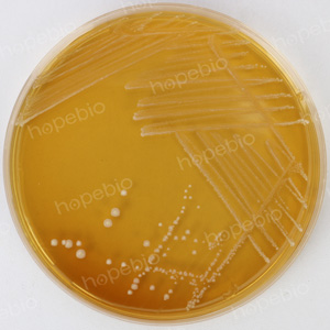 肠膜明串珠菌在APT琼脂上的菌落特征/