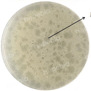 大肠杆菌噬菌体MS2在双层平板上形成的噬菌斑